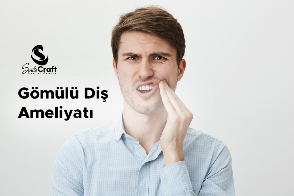 Gömülü Diş Ameliyatı  