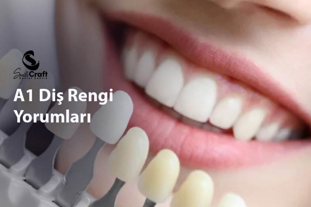 A1 Diş Rengi Yorumları
