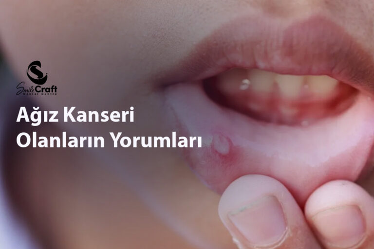 Ağız Kanseri Olanların Yorumları