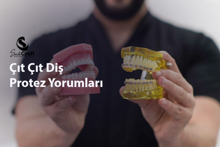 Çıt Çıt Diş Protez Yorumları