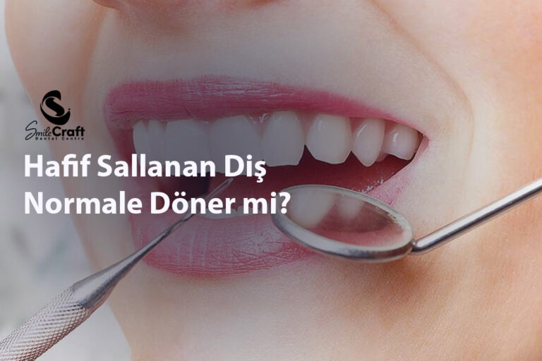 Hafif Sallanan Diş Normale Döner mi?