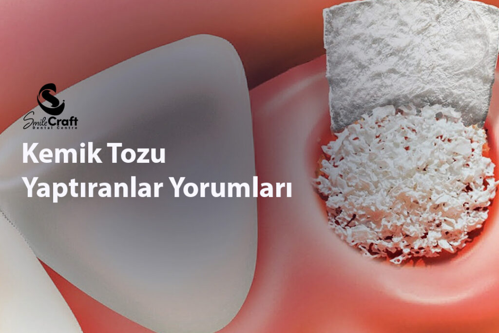 Kemik Tozu Yaptıranlar Yorumları