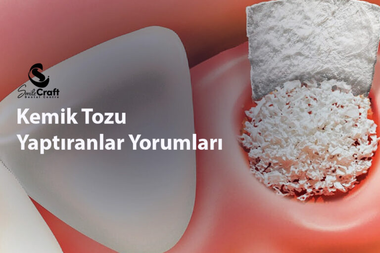 Kemik Tozu Yaptıranlar Yorumları