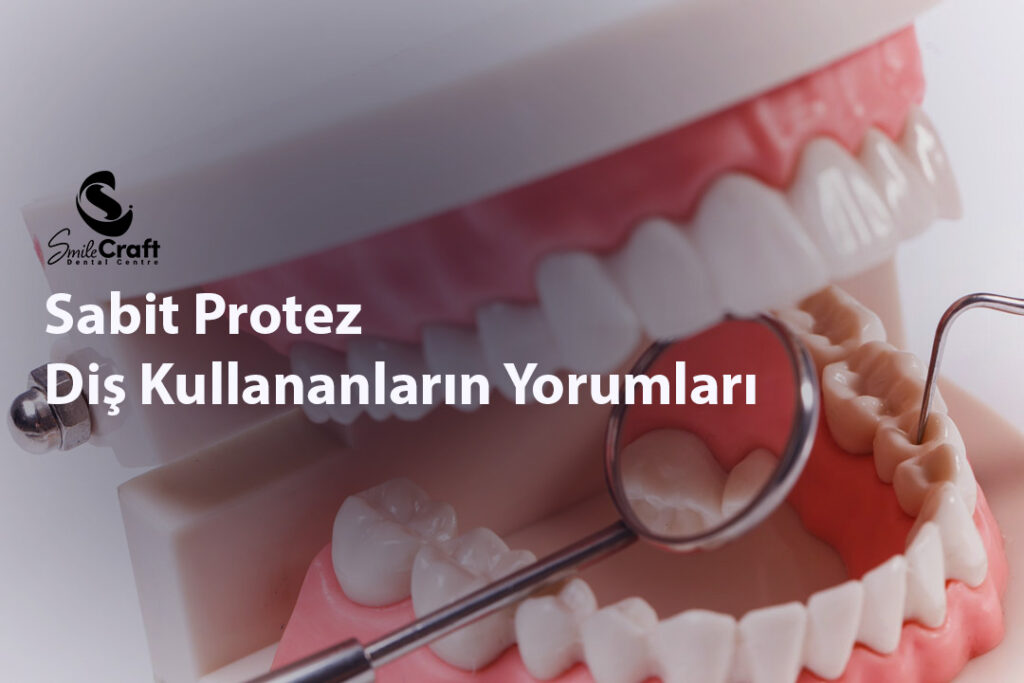 Sabit Protez Diş Kullananların Yorumları