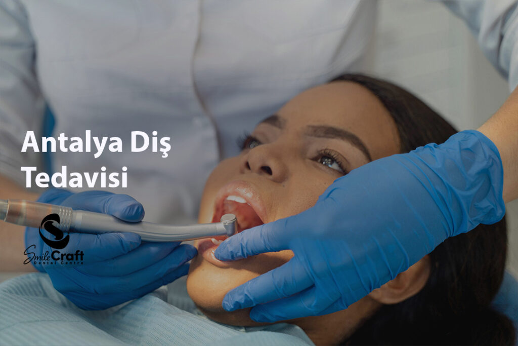 Antalya Diş Tedavisi