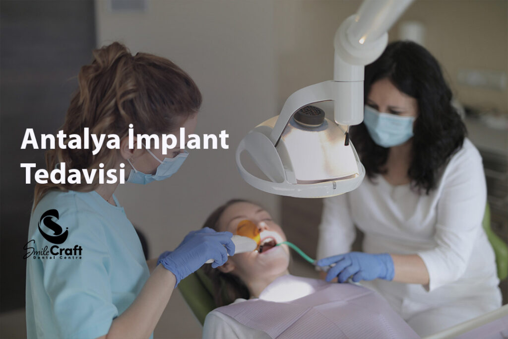 Antalya İmplant Tedavisi