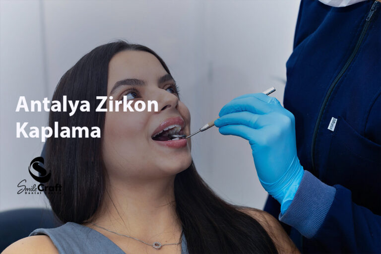 Antalya Zirkon Kaplama