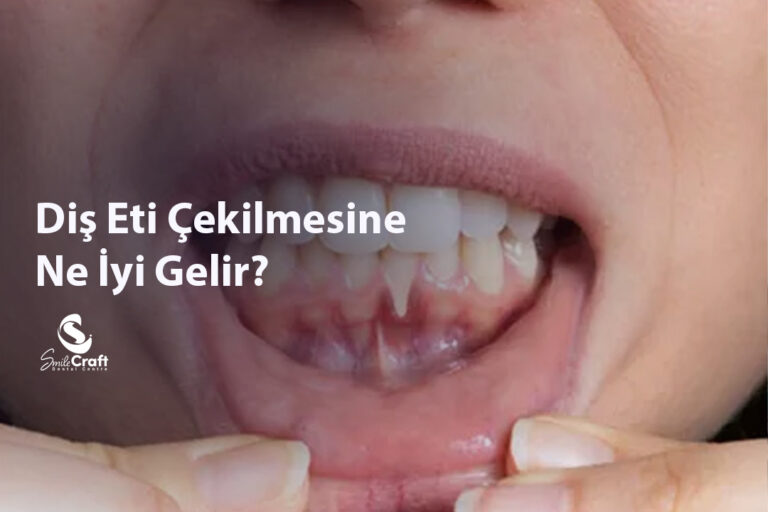 Diş Eti Çekilmesine Ne İyi Gelir?
