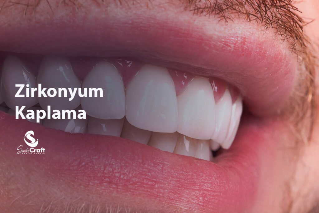 Zirkonyum Kaplama