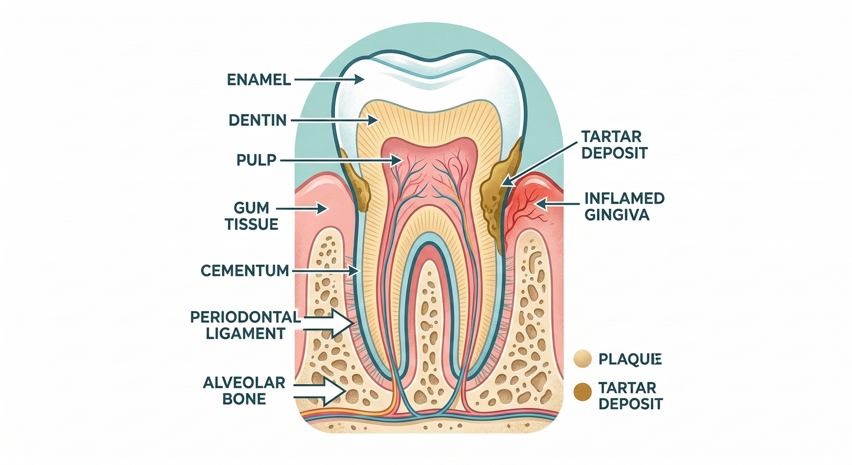 Diş taşı ve plak oluşumu diş kesit anatomisi